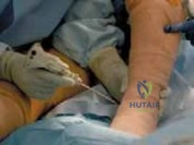 Clinical Image
