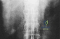 Clinical Image