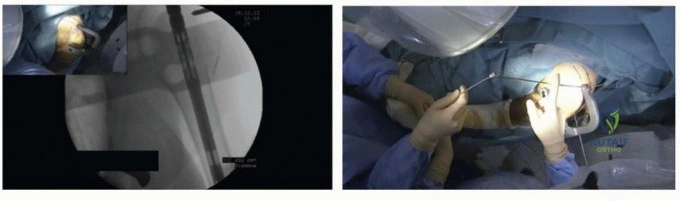Clinical Image