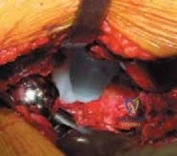 Clinical Image