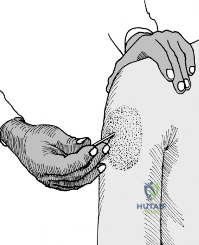 Clinical Image