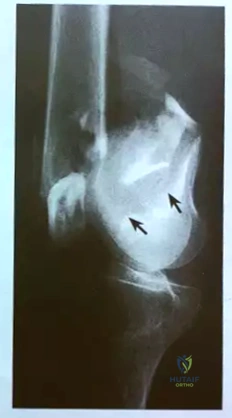 Clinical Image