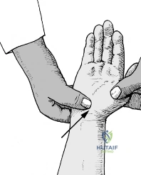 Clinical Image