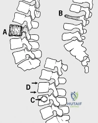 Clinical Image