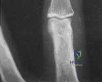 Clinical Image