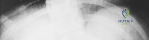 Clinical Image