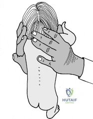 Clinical Image