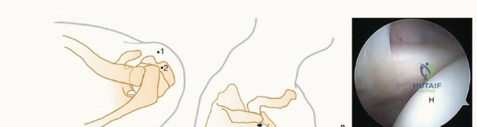 Clinical Image