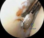 Clinical Image