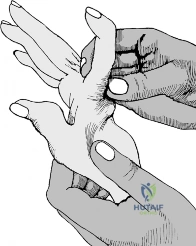 Clinical Image