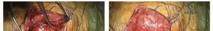 Clinical Image