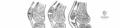 Clinical Image