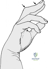Clinical Image