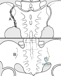 Clinical Image