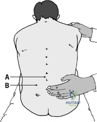 Clinical Image