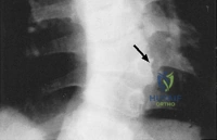 Clinical Image