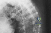 Clinical Image
