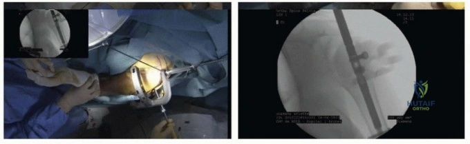 Clinical Image