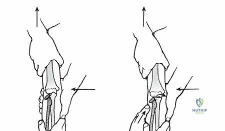 Clinical Image