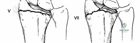 Clinical Image