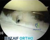 Clinical Image