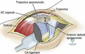 Clinical Image