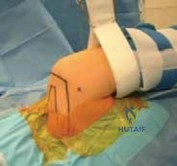 Clinical Image