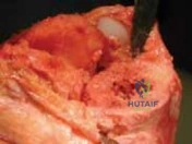 Clinical Image