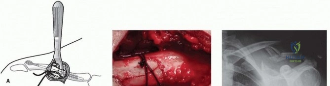 Clinical Image