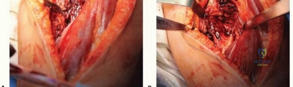 Clinical Image
