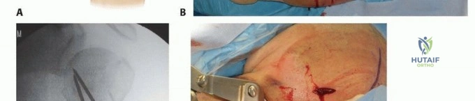 Clinical Image