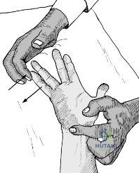 Clinical Image