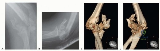 Clinical Image