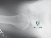 Clinical Image