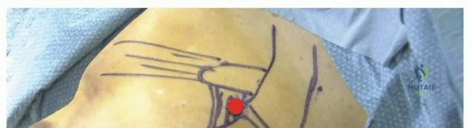 Clinical Image