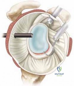 Clinical Image
