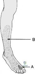 Clinical Image