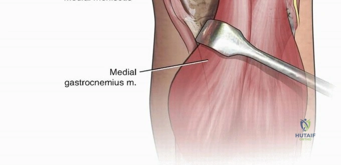 Clinical Image