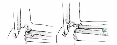Clinical Image