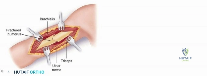 Clinical Image