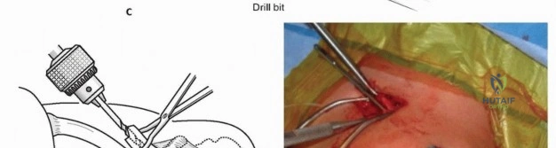 Clinical Image