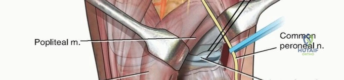 Clinical Image