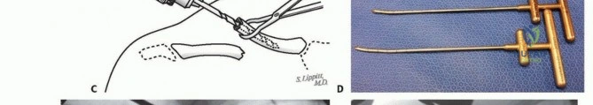 Clinical Image