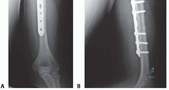 Clinical Image