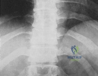 Clinical Image