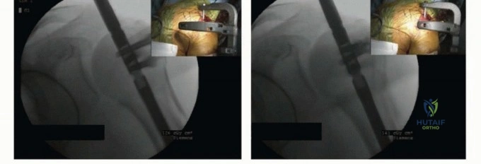 Clinical Image