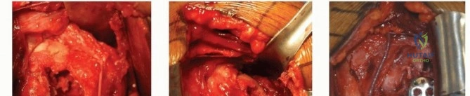 Clinical Image