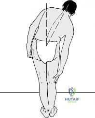 Clinical Image