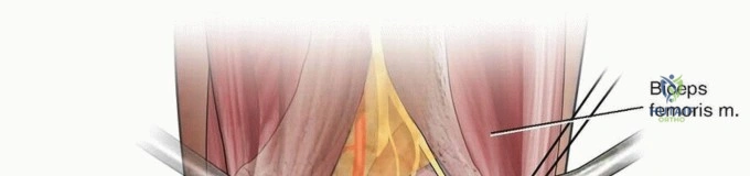 Clinical Image