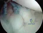 Clinical Image